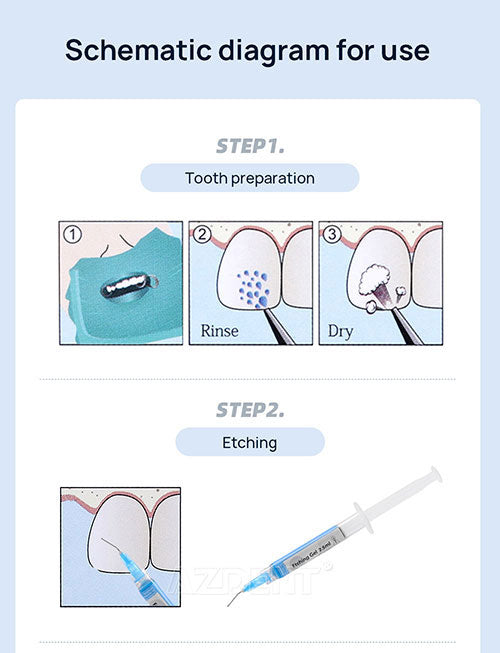 Orthodontic Bonding Light Cure Adhesive Kit Syringes 3pcs 10.5g-azdentall.com Orthodontic Bonding Light Cure Adhesive Kit Syringes 3pcs 10.5g-azdentall.com