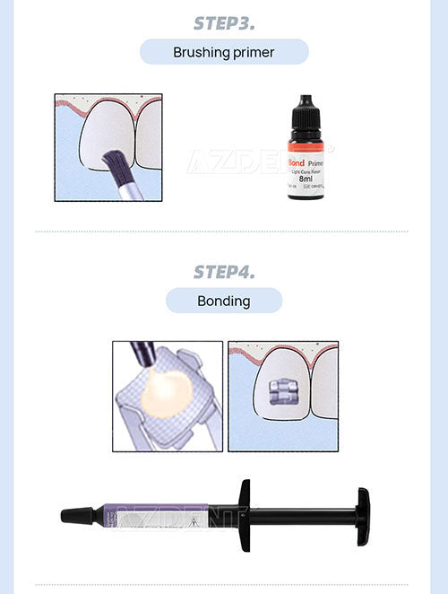 Orthodontic Bonding Light Cure Adhesive Kit Syringes 3pcs 10.5g-azdentall.com Orthodontic Bonding Light Cure Adhesive Kit Syringes 3pcs 10.5g-azdentall.com