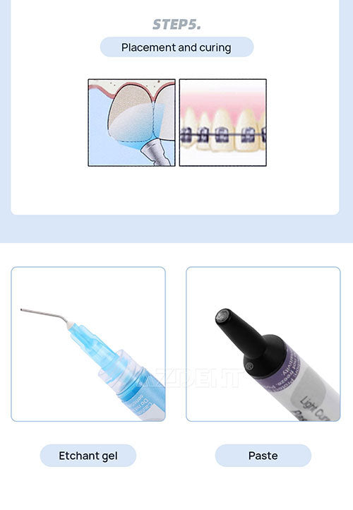 Orthodontic Bonding Light Cure Adhesive Kit Syringes 3pcs 10.5g-azdentall.com Orthodontic Bonding Light Cure Adhesive Kit Syringes 3pcs 10.5g-azdentall.com