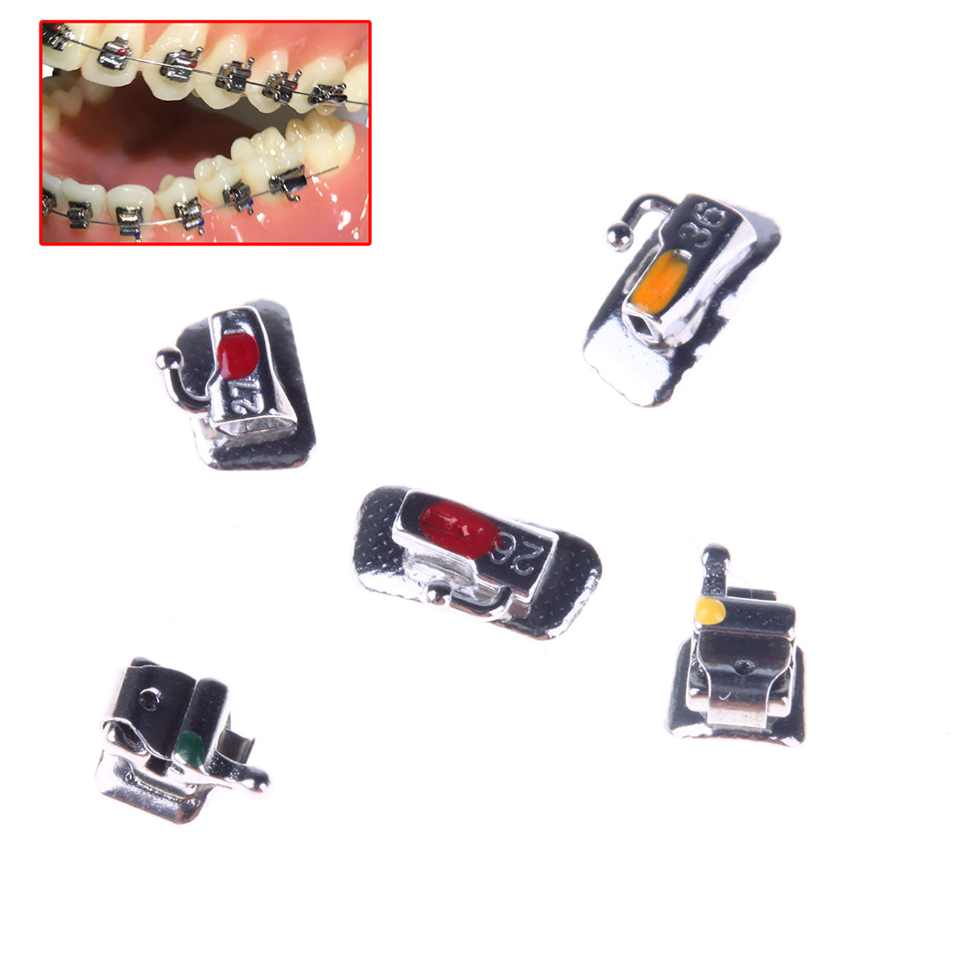 AZDENT Dental Orthodontic Metal Self Ligating Brackets Braces Mini Roth .022 Hooks on 345 with Buccal Tube 28pcs/Kit - azdentall.com AZDENT Dental Orthodontic Metal Self Ligating Brackets Braces Mini Roth .022 Hooks on 345 with Buccal Tube 28pcs/Kit - azdentall.com