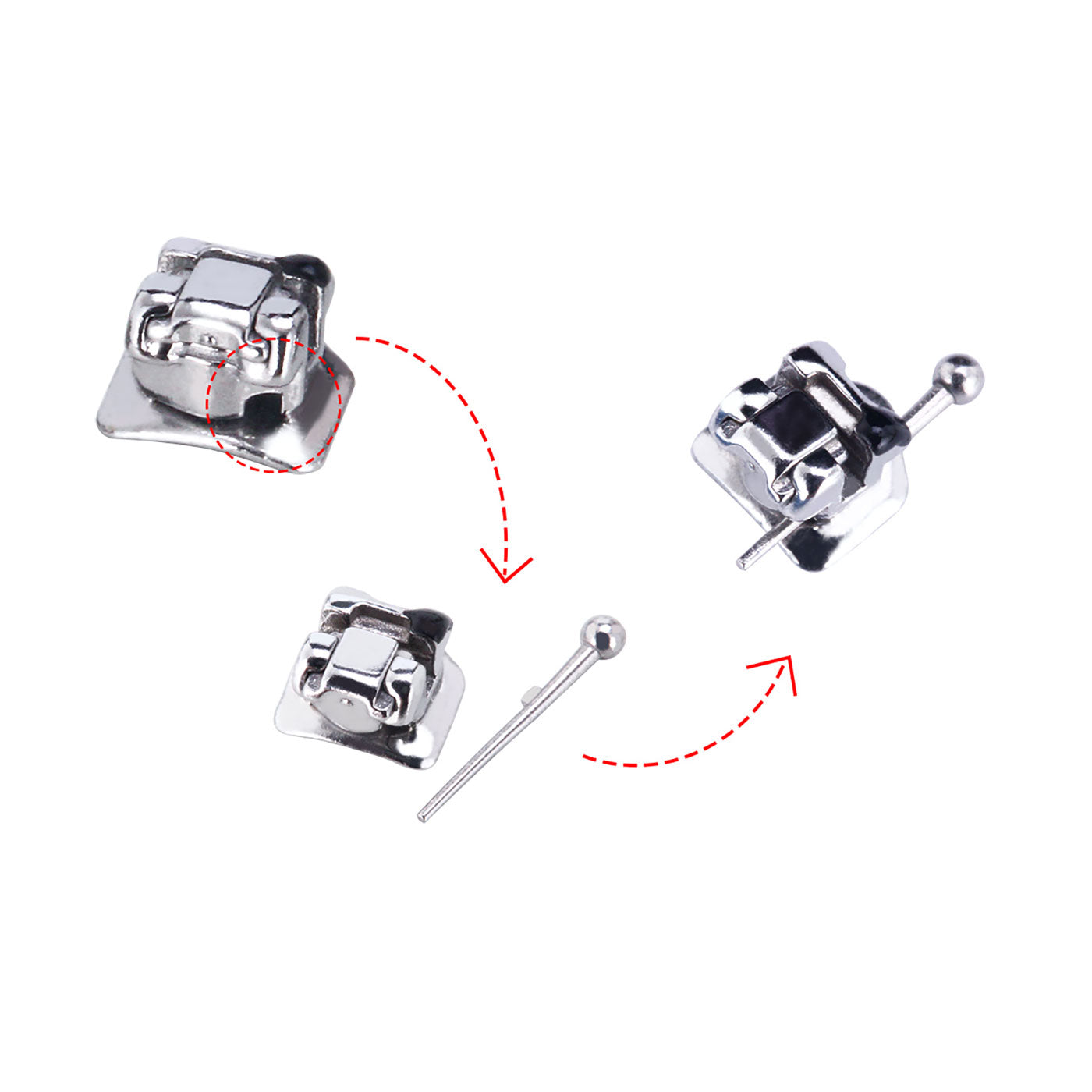 AZDENT Dental Orthodontic Metal Self-Ligating Brackets Braces MBT .022 Hooks on 345 with Buccal Tube 28pcs/Kit - azdentall.com