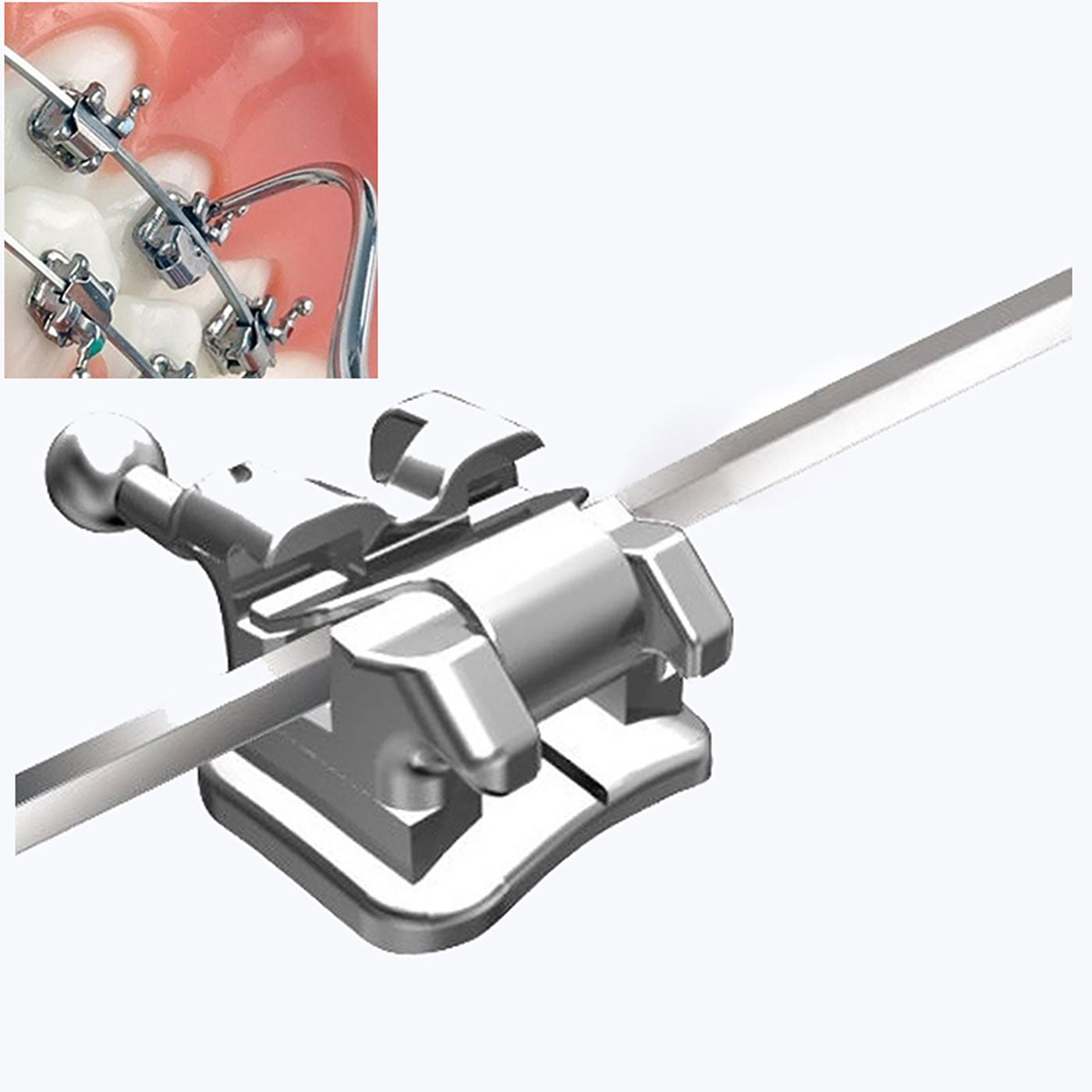 AZDENT Dental Orthodontic Metal Self Ligating Brackets Braces Mini Roth .022 Hooks on 345 with Buccal Tube 28pcs/Kit - azdentall.com AZDENT Dental Orthodontic Metal Self Ligating Brackets Braces Mini Roth .022 Hooks on 345 with Buccal Tube 28pcs/Kit - azdentall.com