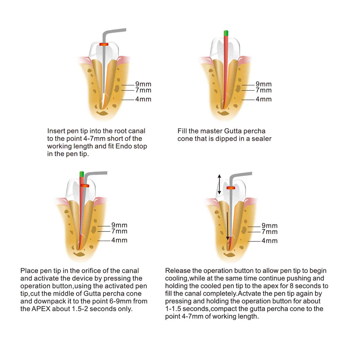 Dental Wirelesss Gutta Percha Obturation Endo Heated Pen