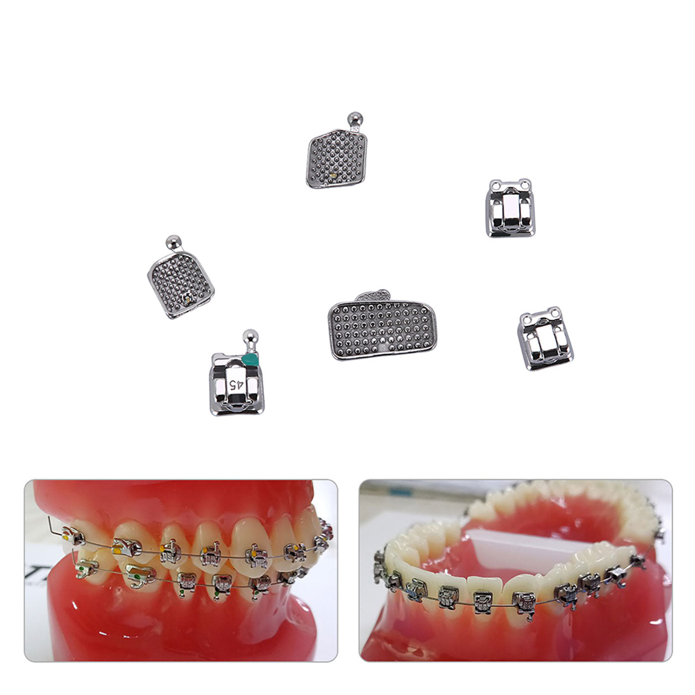 AZDENT Dental Orthodontic Metal Self Ligating Mini Bracket Braces Roth .022 Hooks 345 With 4 Buccal Tube 20+4/Box - azdentall.com AZDENT Dental Orthodontic Metal Self Ligating Mini Bracket Braces Roth .022 Hooks 345 With 4 Buccal Tube 20+4/Box - azdentall.com
