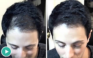 Person with short wavy black hair and has thin hair on the left side of their frontal scalp