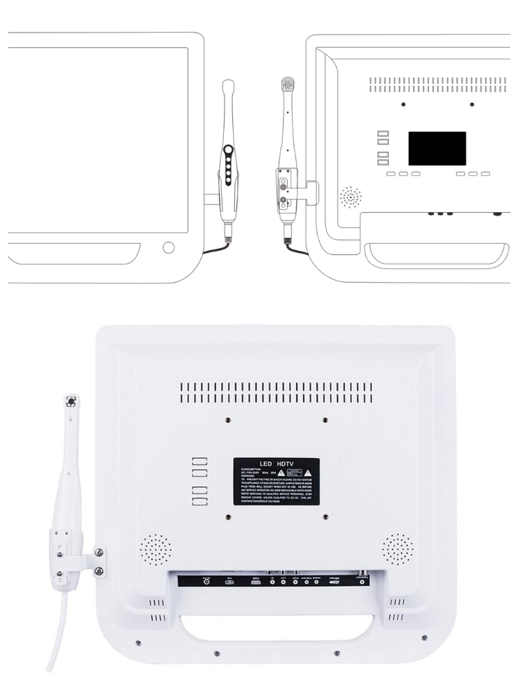 intraoral camera dental equipment