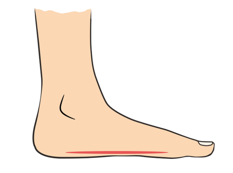 Orthotic Foot Insole