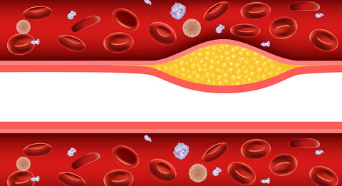 blood lipid