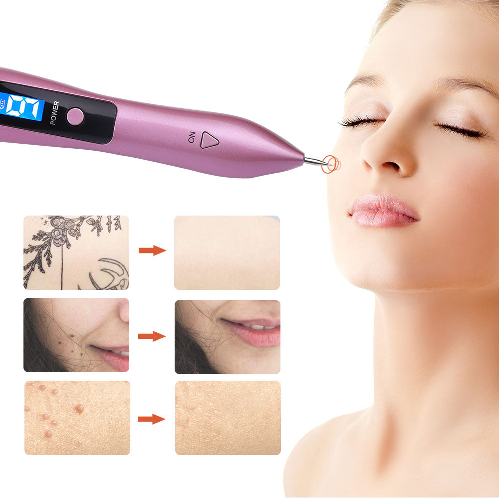 Skin Tag Remover Pen, Mole Remover Pen, Dark Spot Remover, Boho Beauty Gadgets