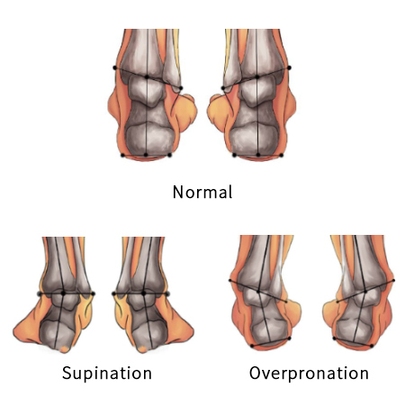 Under supination sales