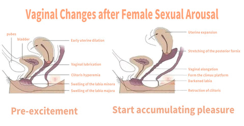 vagina changes after female sexual arousal