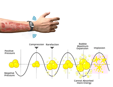 Slimani Ultrasonic Body Shape Wristband