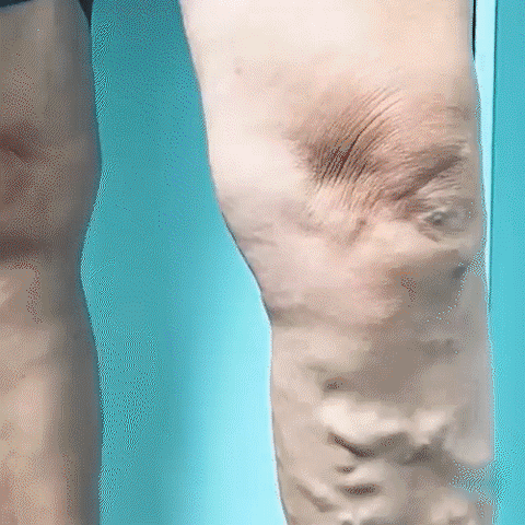 Slimani Ultrasonic Body Shape Wristband