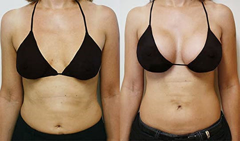 NatureUp™ Breast Plumping&Firming Cream