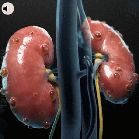 Kidney Support Herbal Foot Soak Kidney Detox