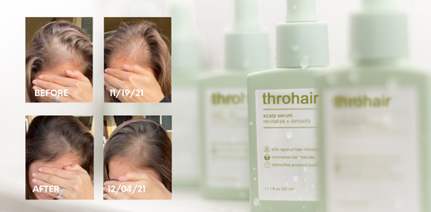 Throhair™Scalp Serum