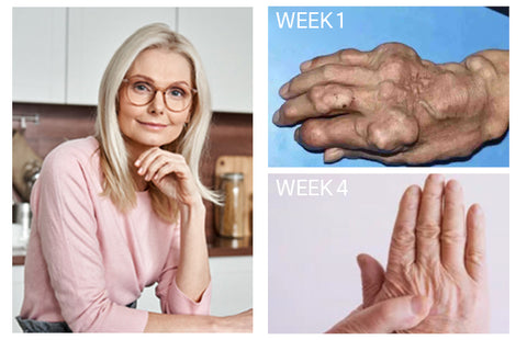 ArthriPro™ UC-II Powerful Relief Spray