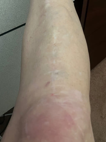 Joint & Muscle & Scar Therapy Tape