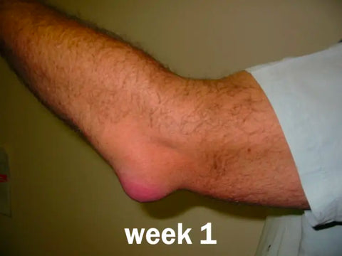 ArthriPro™ UC-II Powerful Relief Spray