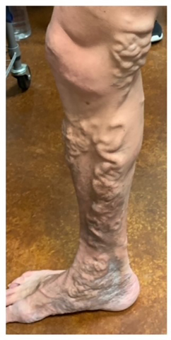 Medmax™ Tourmaline Self-heating Knee Sleeve