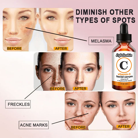 Exfolieskin™ Dark Spot Corrector & Anti-Aging Collagen Serum
