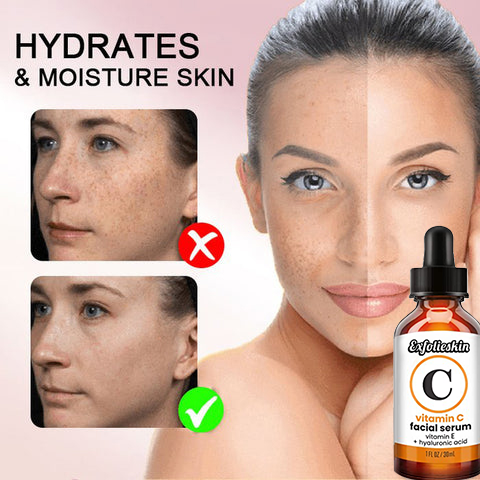 Exfolieskin™ Dark Spot Corrector & Anti-Aging Collagen Serum