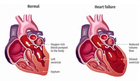 HeartFlash® Organic Herbal heart Cleansing Spray