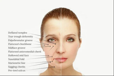 InstaLift Korea Protein Thread Lifting Set