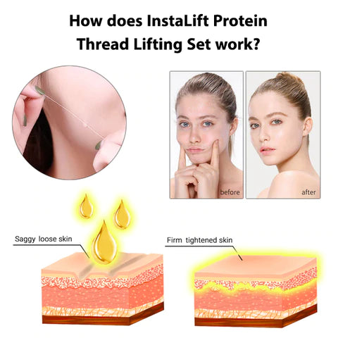 InstaLift Korea Protein Thread Lifting Set
