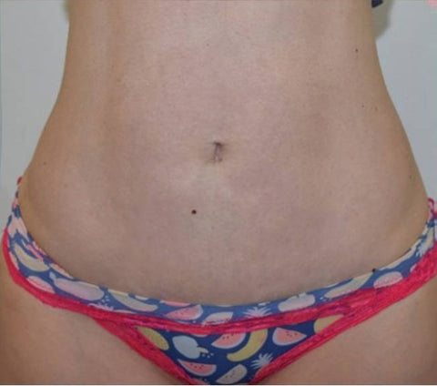 TLOPA™ Graphene Fiber Restoration Briefs