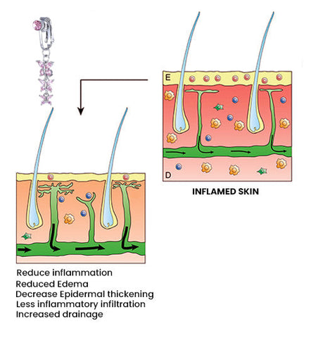 FatLoss™ LymphDrainage SlimFit MagneticTherapy BellyButton Rings