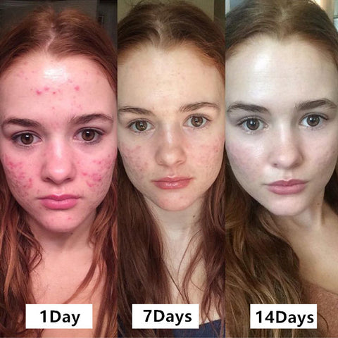 Nauraille™ Phyto Corrective Soothing Fluid