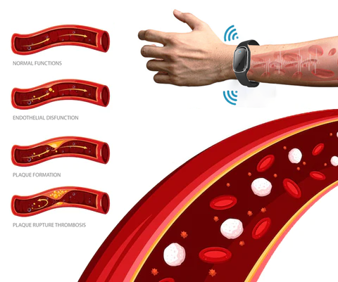 CC™ Ultrasonic Ultra-Tech Body Shape Wristband 