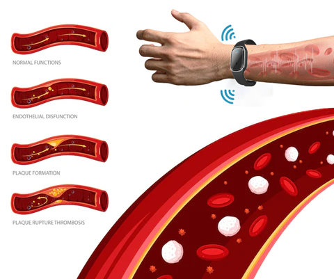 CC™ Ultrasonic Ultra-Tech Body Shape Wristband
