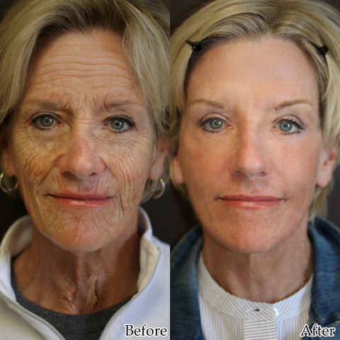 Fivfivgo™ BeautFPRO Golden Age Ultimativ verfeinerndes Anti-Aging-Serum