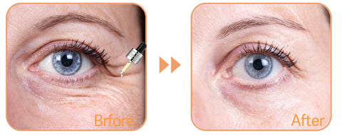 Fivfivgo™ BeautF Golden Age Ultimate Refining Anti-Aging Serum