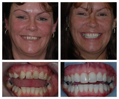 Teethyouth Tooth Regrowth Gel 