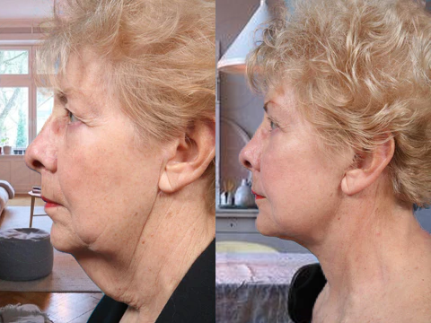 Beatyshape™ HerbalDetoxing AntiCellulite Jelly Soap