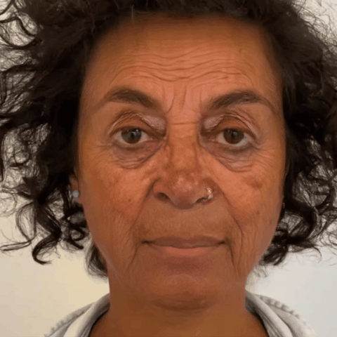 SkinReju™ Plant Stem Cell & Ceramide Lifting Serum