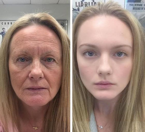 SkinReju™ Plant Stem Cell & Ceramide Lifting Serum