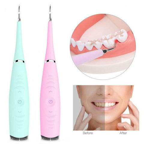 Ultrasonic Tooth Cleaning Wand – VixenSmile