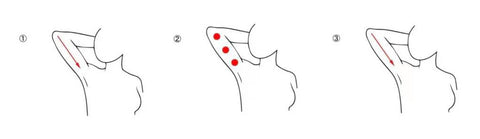 Butterfly sleeve firming care