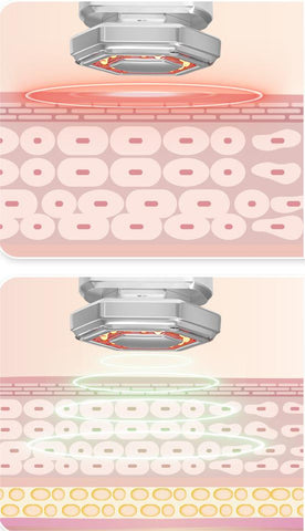 PMPM pulse double ring beauty instrument firming, shaping, rejuvenating and anti-acne halohk