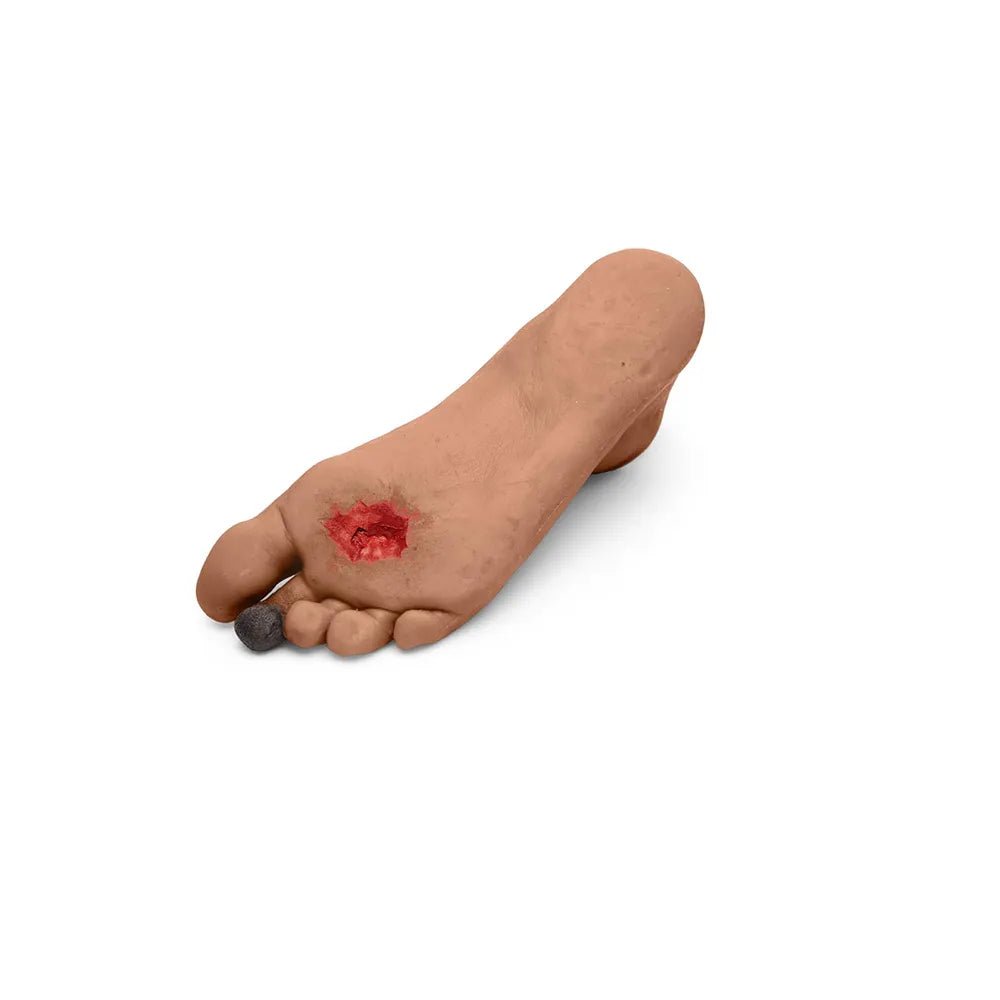 CAE Medicor Diabetic Foot Trainer