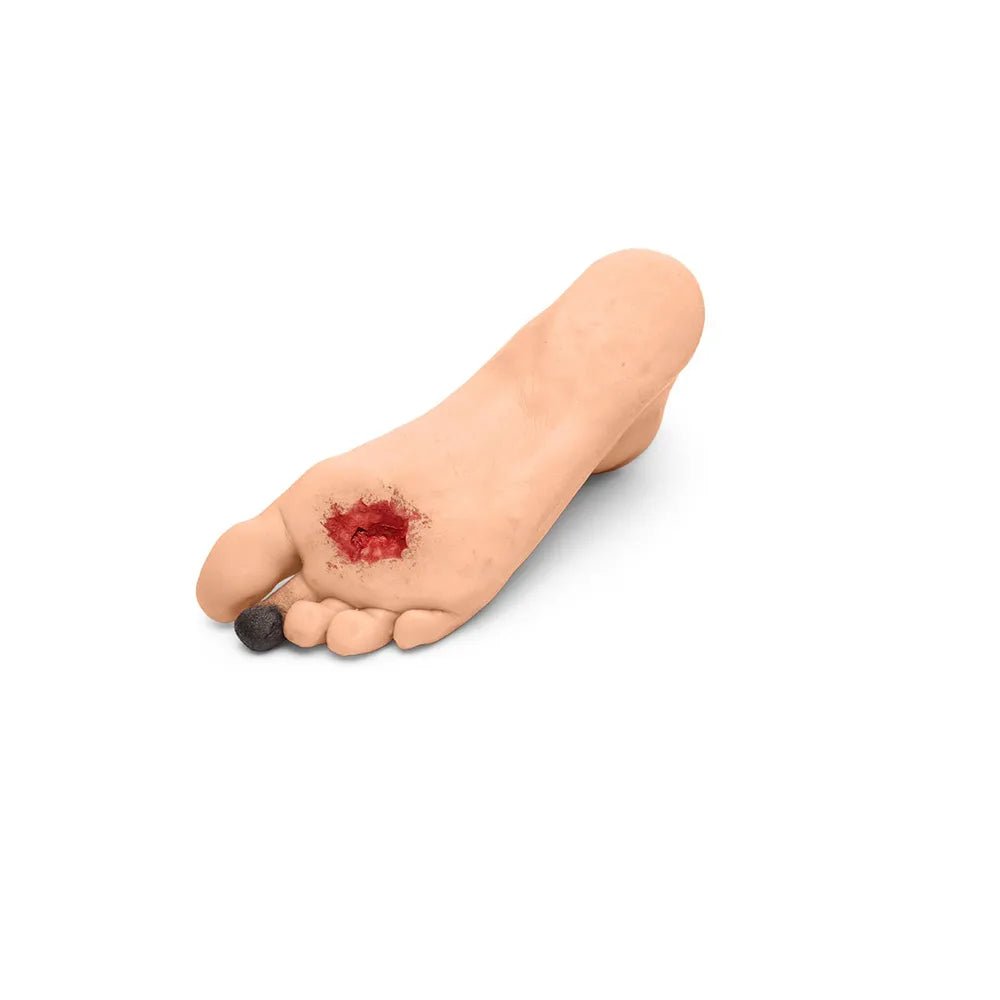 CAE Medicor Diabetic Foot Trainer