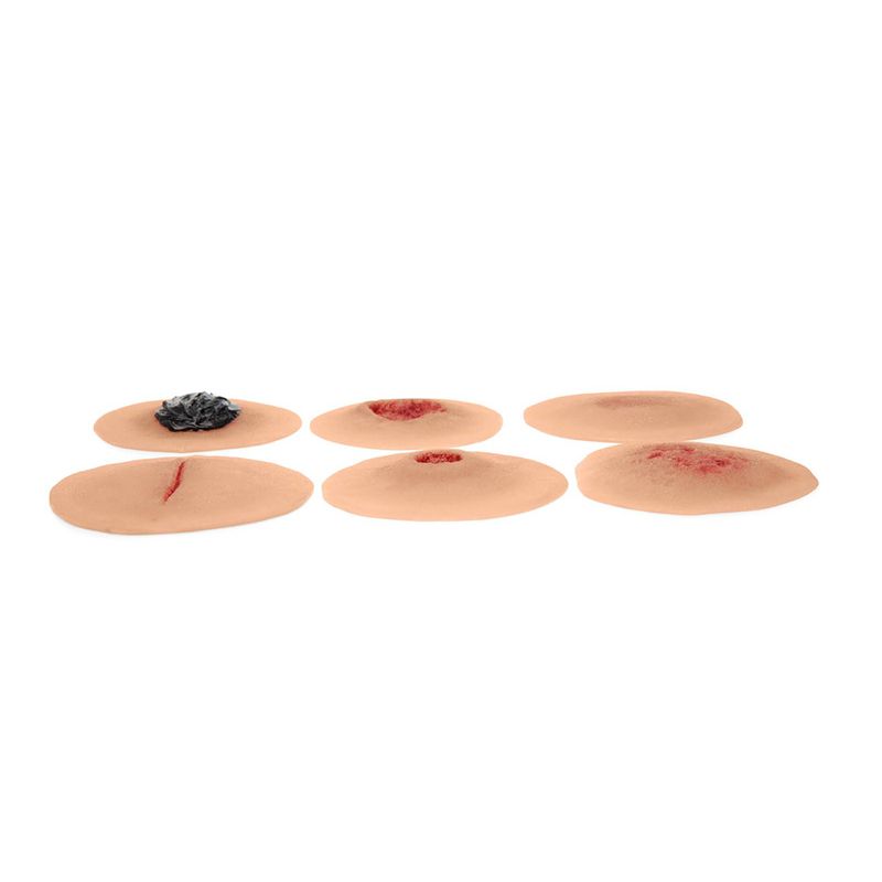 Sticky Wound Kit 6 PC