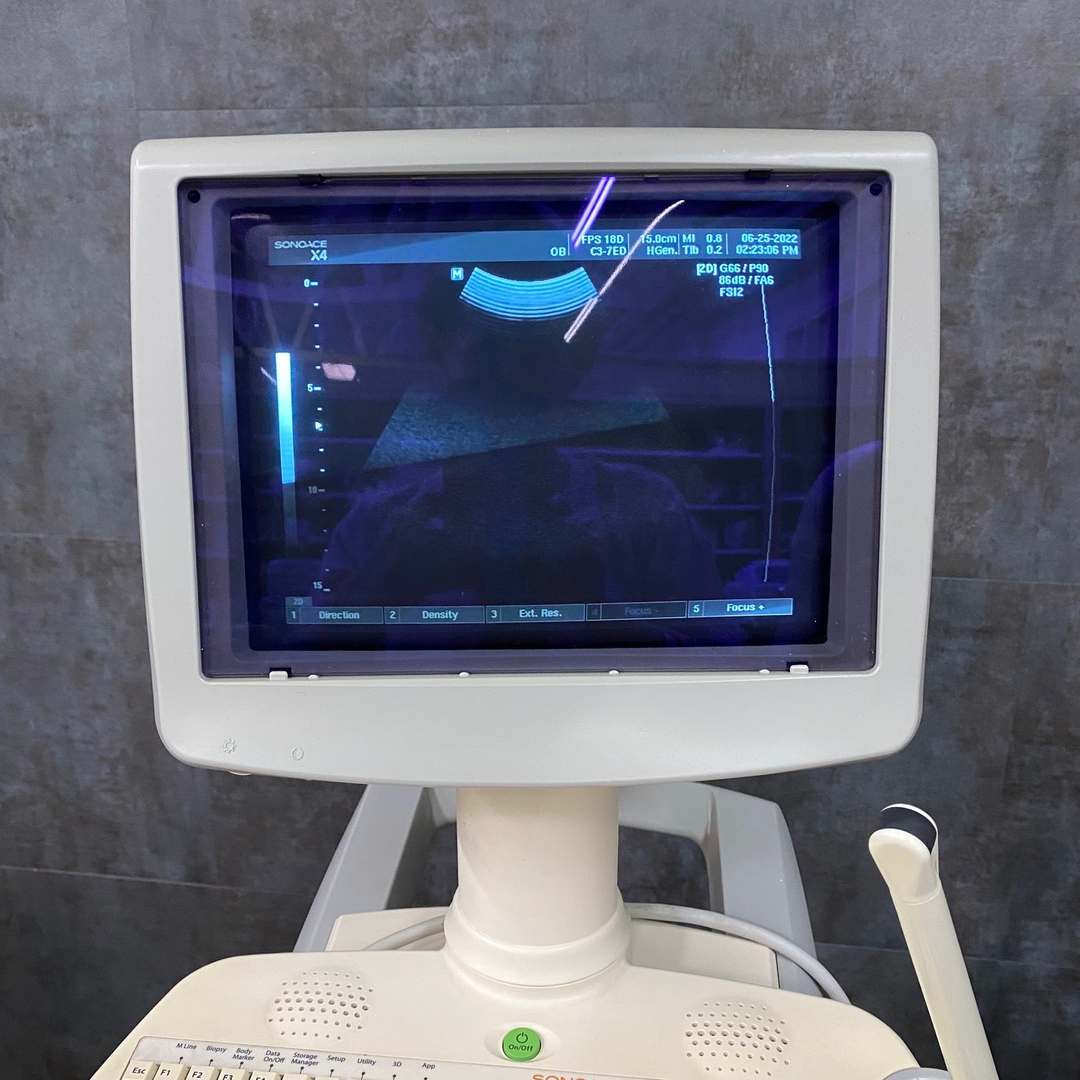 Medison SonoAce X4 Ultrasound Unit