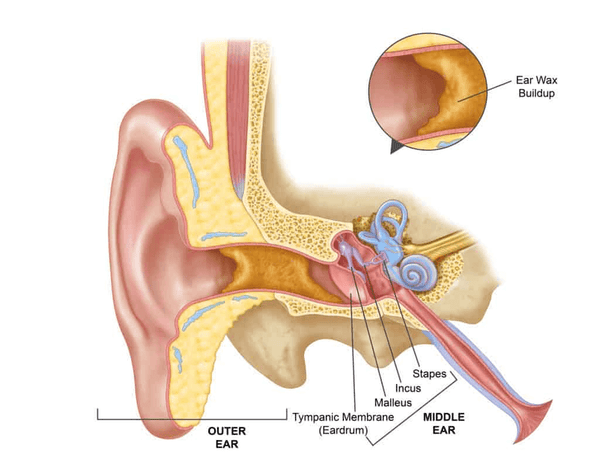 How to clean your ears