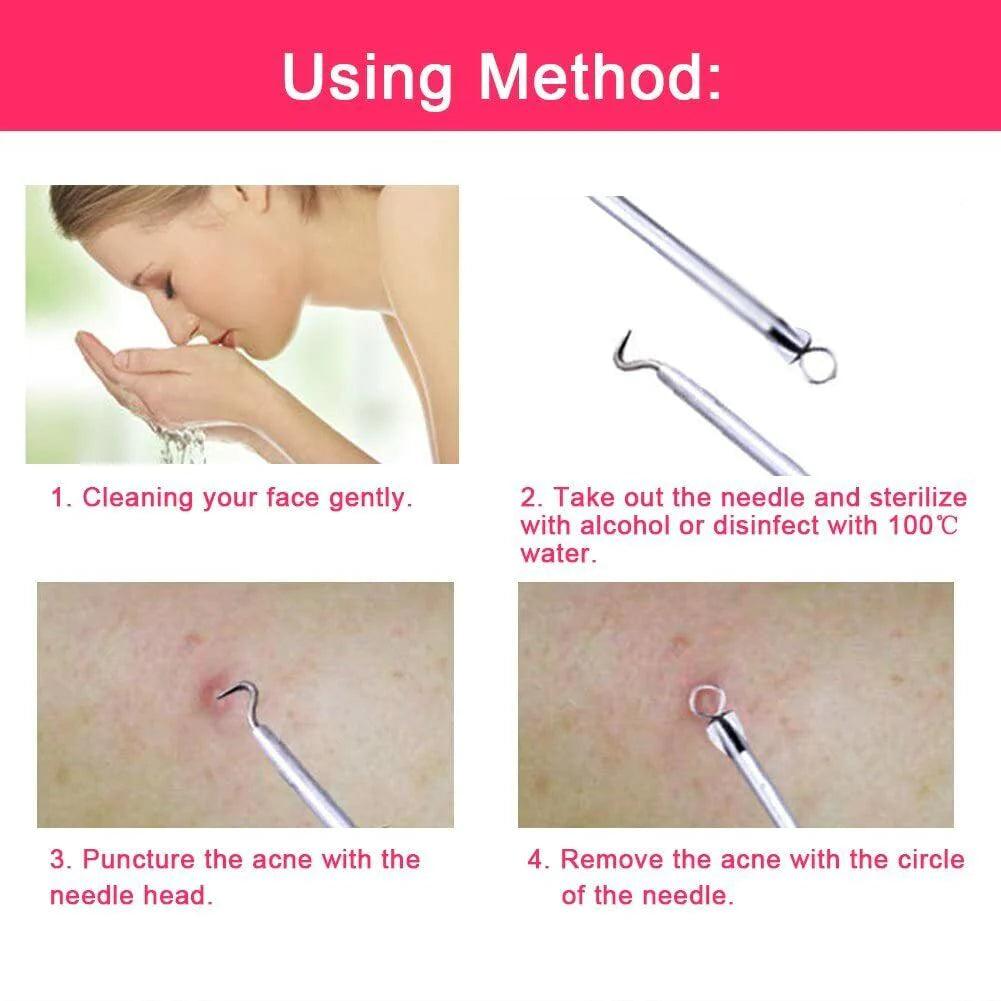 Ear Wax Removal Kit Cleaning Tool Earwax Pick Cleaner Curette Spoon Setstainless