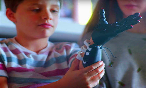 Four cases of terrific 3D printing technology | 3D Printed Prostheses hands